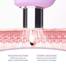 KIWI derma Diamond Microdermabrasion & Pore Vacuum | Lavender