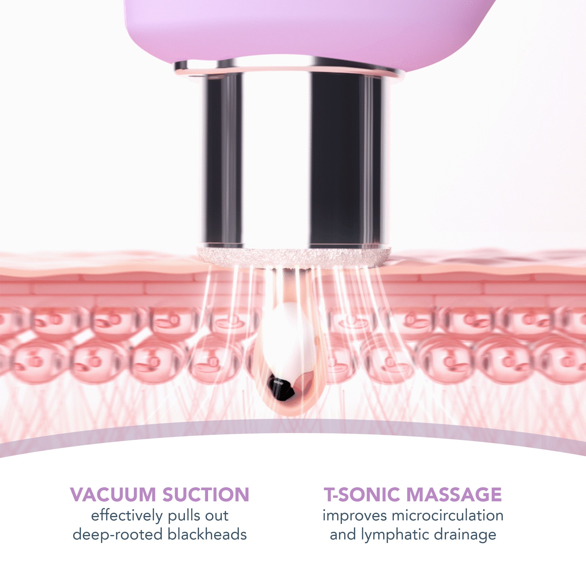 KIWI derma Diamond Microdermabrasion & Pore Vacuum | Lavender
